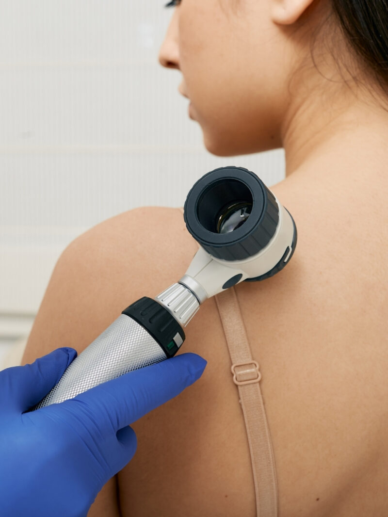 dermatologia analisi della cute