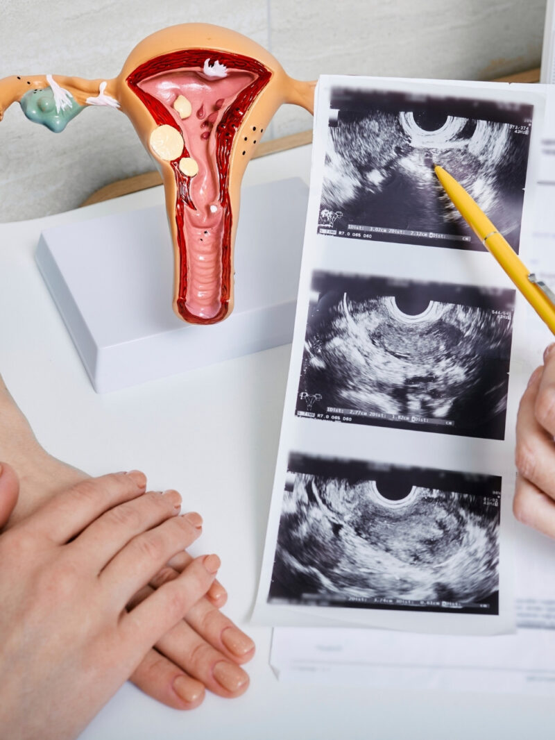 ginecologia e salute della donna