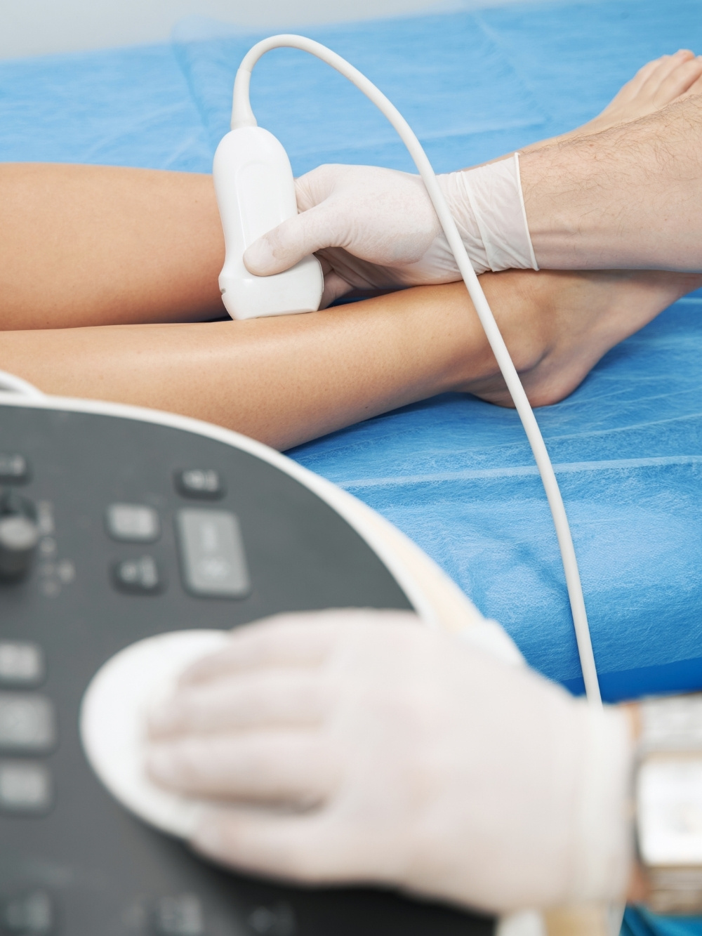 esame ecocolordoppler alle gambe